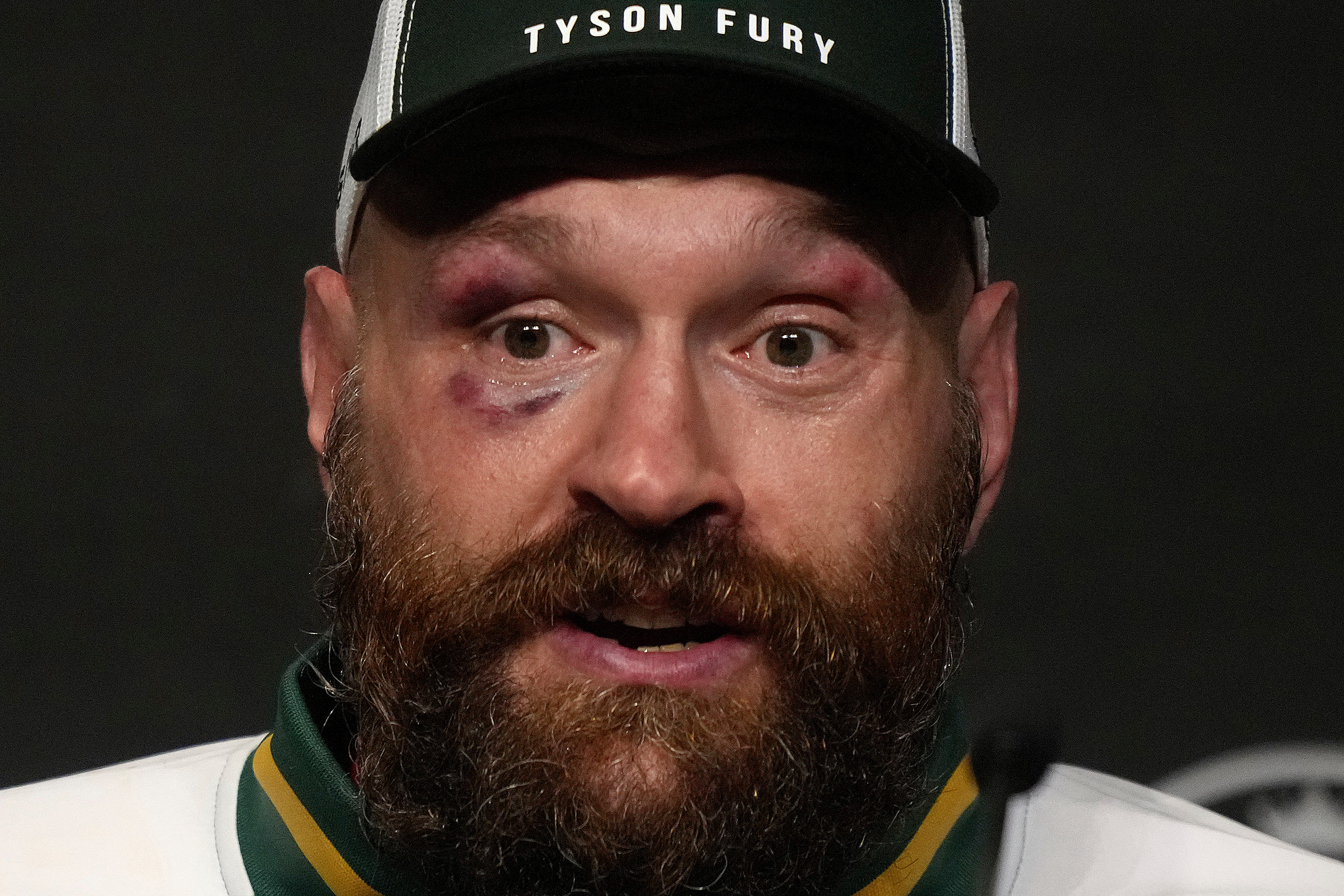 Tyson Fury Age: How Old Is Tyson Fury In 2026?